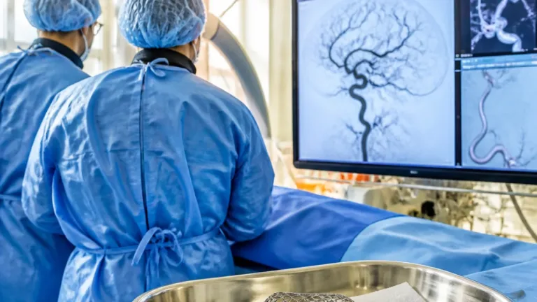 La Plata: el Hospital San Martín realizó el primer tratamiento público con dispositivo WEB para aneurismas