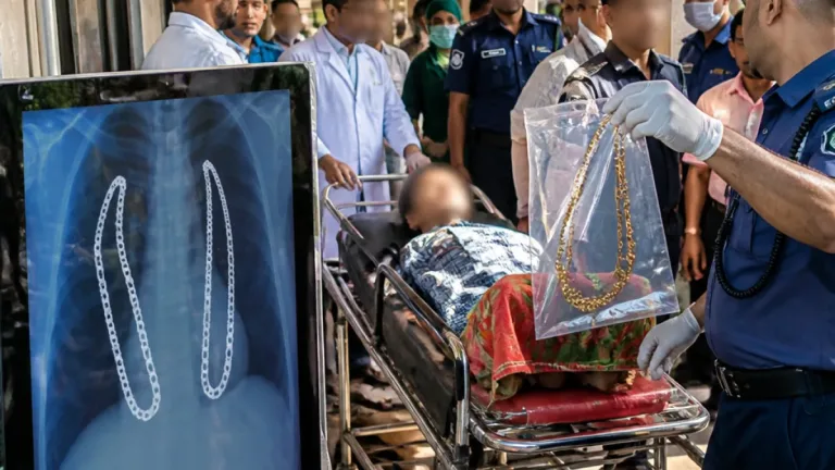 হাসপাতালে চুরি, সন্দেহভাজন নারীকে আটক—এক্সরে পেটে মিলল দুই সোনার চেইন