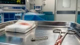فريق جراحي في مستشفى دمياط العام ينجح في استخراج دبوس من رئة مريضة وينقذ حياتها