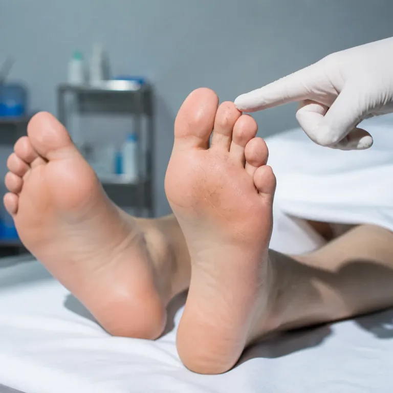 Amikor a lábujjszőr is üzen: mit árul el a szőrzet a láb keringéséről?